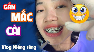 NGÀY ĐẦU TIÊN NIỀNG RĂNG NHƯ THẾ NÀO? | GẮN MẮC CÀI