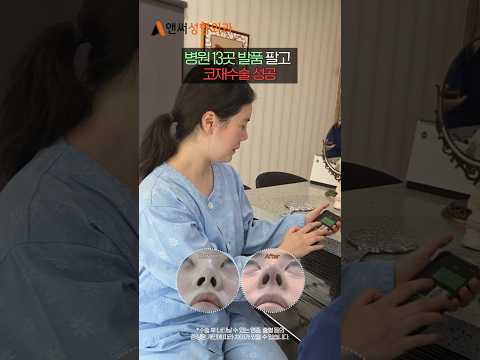 늑연골코재수술 (들린코교정+휜코교정) 2주 전후 👃