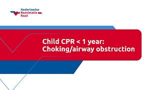 Child CPR younger than 1 year: Choking/airway obstruction