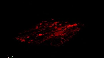 Brain Cell 3D Reconstruction of B-SIM298 Structured Illumination Fluorescence Microscope