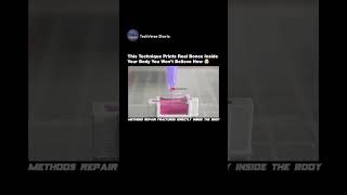 Scientists Want To 3D Print Bones In Your Body