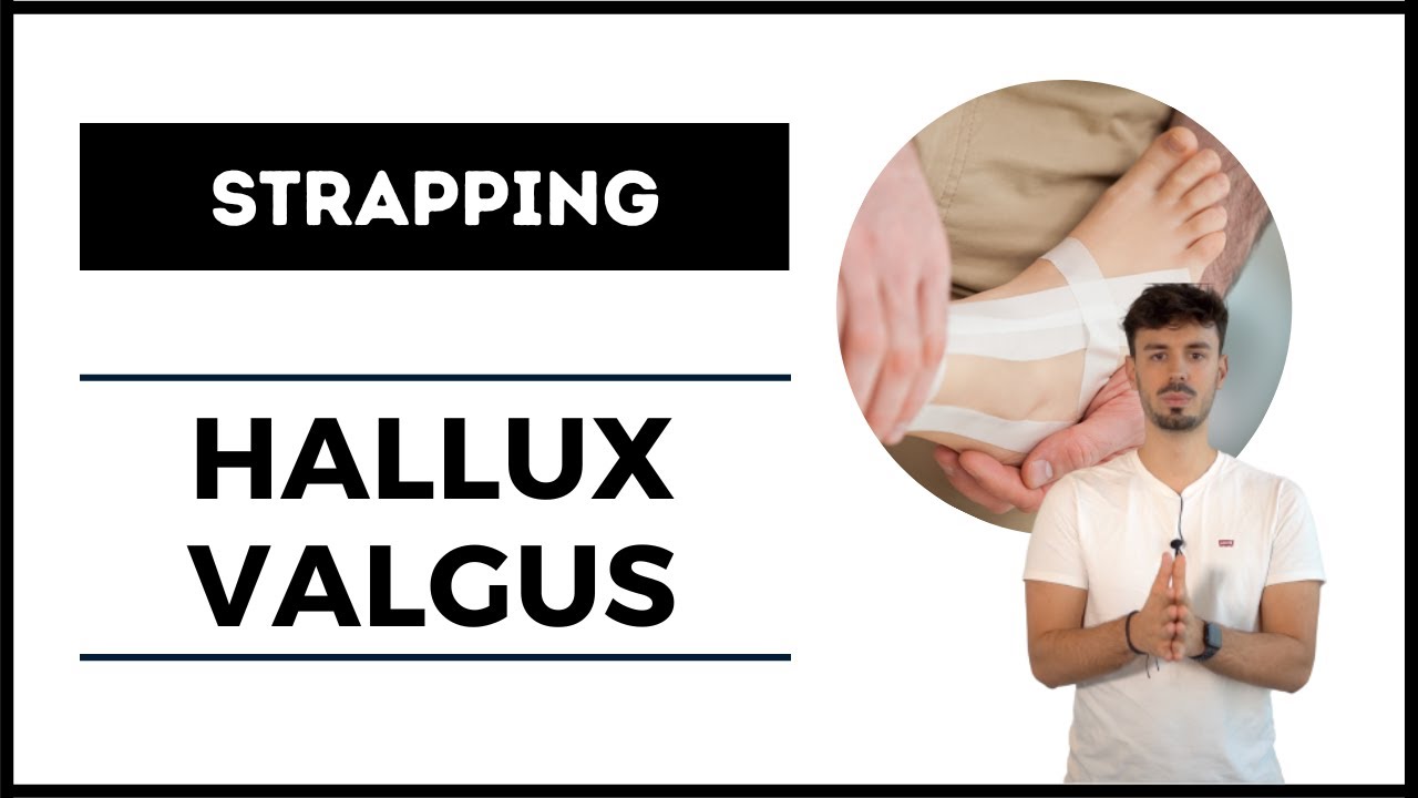 STRAPPING DE L'HALLUX VALGUS