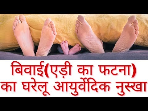 बिवाई का घरेलु इलाज #AyurvedicTips For Foot Heel Dry Skin(बिवाइ/एड़ी का फटना)|Home Remedies