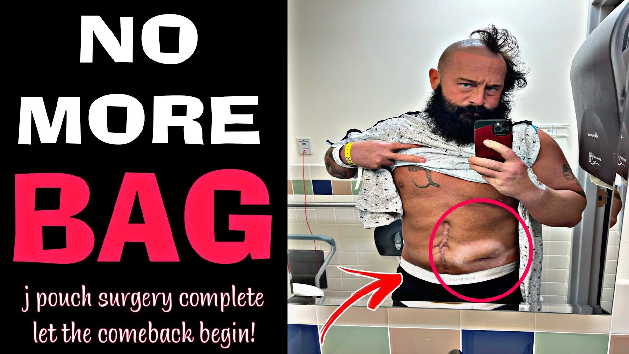 NO MORE BAG (JPouch Update) YouTube
