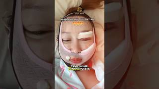 Download Lagu Daftar Artis Indonesia yang Jalani Operasi Plastik di Korea Selatan pada 2024! #oplas#mahalini#fyp MP3 Download Lagu Daftar Artis Indonesia yang Jalani Operasi Plastik di Korea Selatan pada 2024! #oplas#mahalini#fyp MP3
