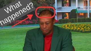 Tiger Woods Winning Interview - Balding Tiger, Hidden Problems by Dr. Dubs 867 views 5 years ago 1 minute, 16 seconds