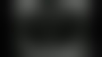 Asvide: Interruption of the suprarenal portion of the IVC with azygos continuation