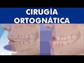 Cirugía ORTOGNÁTICA - Operación de MANDÍBULA para corregir su posición ©