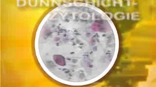 ThinPrep-Test