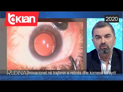 Video: Si funksionon shtresa e kornesë?