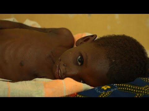 Видео: Где в мире есть области недоедания?