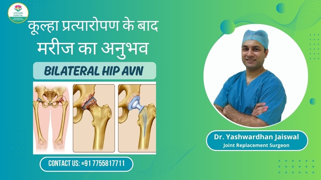 TOTAL HIP REPLACEMENT SURGERY FOR HIP AVN | PATIENT REVIEW | BEST ARTHRITIS DOCTOR IN GORAKHPUR