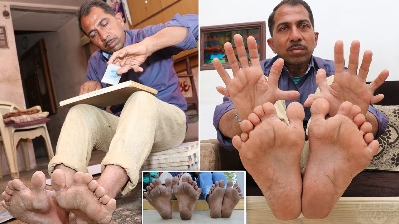 People With Biggest Body Parts No.11  