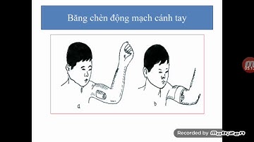 bài 7. Kỉ thuật cấp cứu  chuyển thương - GDQPAN 11