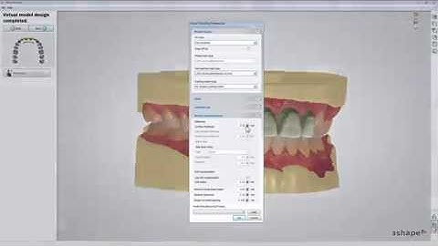 Pshysical Wax up Design