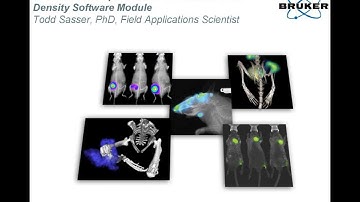 Overview and Operation of The Bruker Bone Density Software