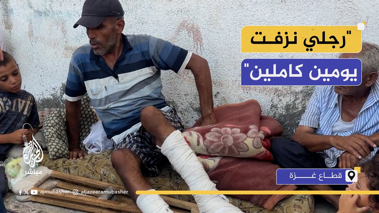 مصاب في "مصائد الموت" يصف لحظات الرعب أثناء محاولته الحصول على مساعدات
