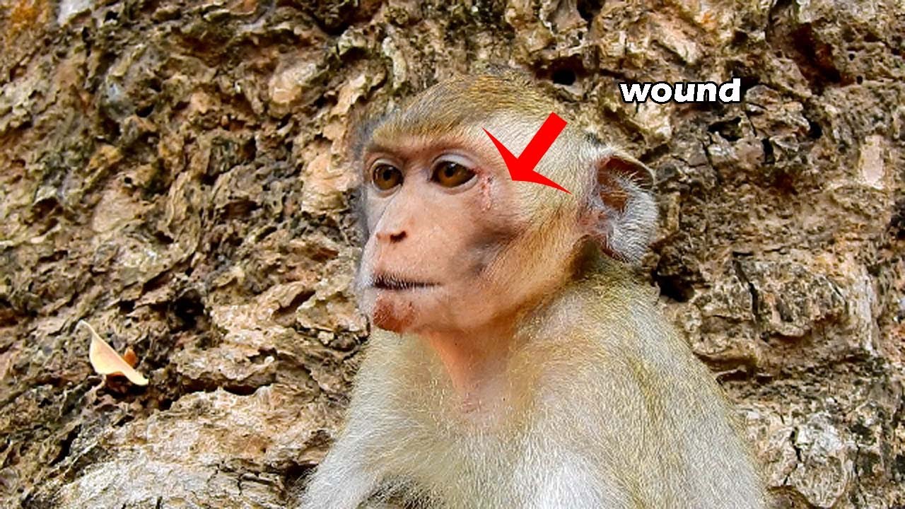 Poor Janna got injury on nearly her eye in time of mom abandon for a while | pity Janna got injury