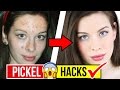 5 ANTI PICKEL HACKS & FEHLER die DU TÄGLICH bei der HAUTPFLEGE machst!! 😨