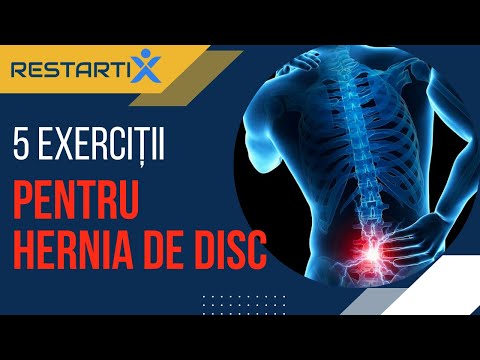 ALEXANDRU ILIE | 5 Exercitii pentru Hernia de Disc Lombară (Kinetoterapie Online)