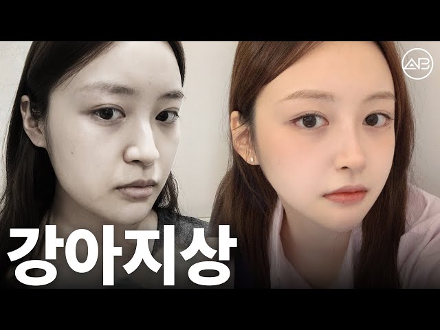 한듯 안한듯 강아지상 되는 방법 | 성형비포애프터 | 에이비성형외과