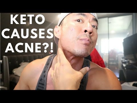 Keto Cut Ep   | Keto Causes Acne? | Peak Week