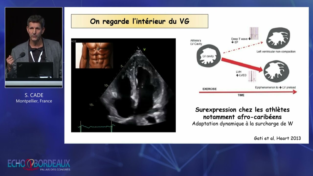 L’écho du sportif : ne rien oublier !