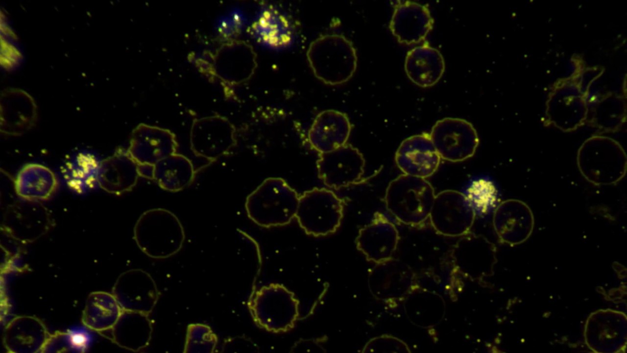 Dunkelfeldmikroskop, Темнопольная микроскопия, microscopie à fond noir — free download