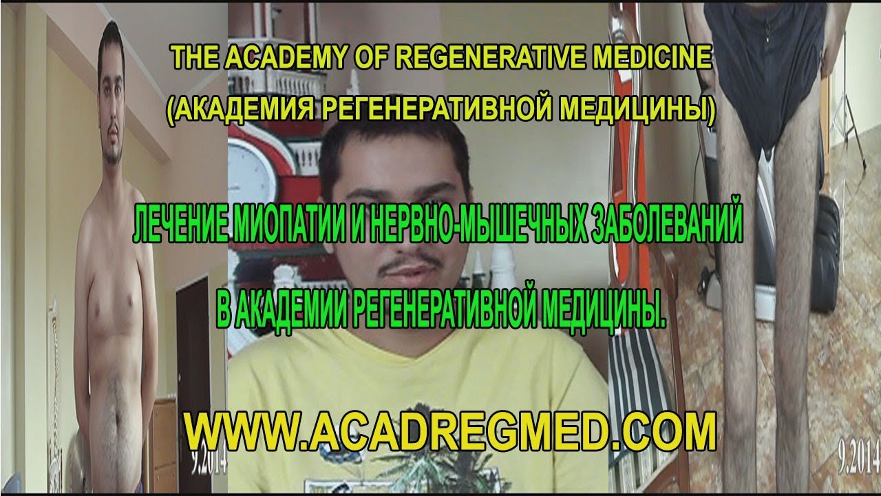 Лечение Миопатии и Нервно-Мышечных заболеваний в Академии ...