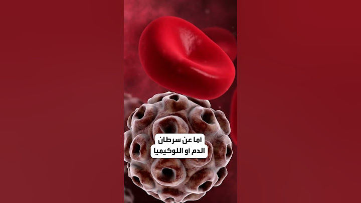 رحيل صادم للتيكتوكر المغربية شيماء بن سعيد بعد أشهر من زواجها.. فما سبب الوفاة؟