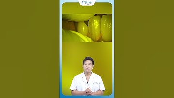 Hàn Răng Sâu Kẽ | Nha Khoa Minh Châu