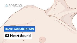 S3 Heart Sound (S3 Gallop) - Heart Auscultation - Episode 9 Resimi