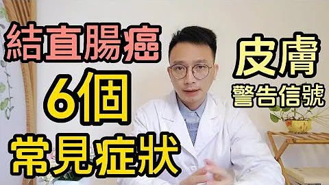 醫生提醒:結直腸癌，這6個常見症狀，是直結腸癌早期徵兆！如果皮膚出現這2個警告信號，你一定要重視！ - 天天要聞