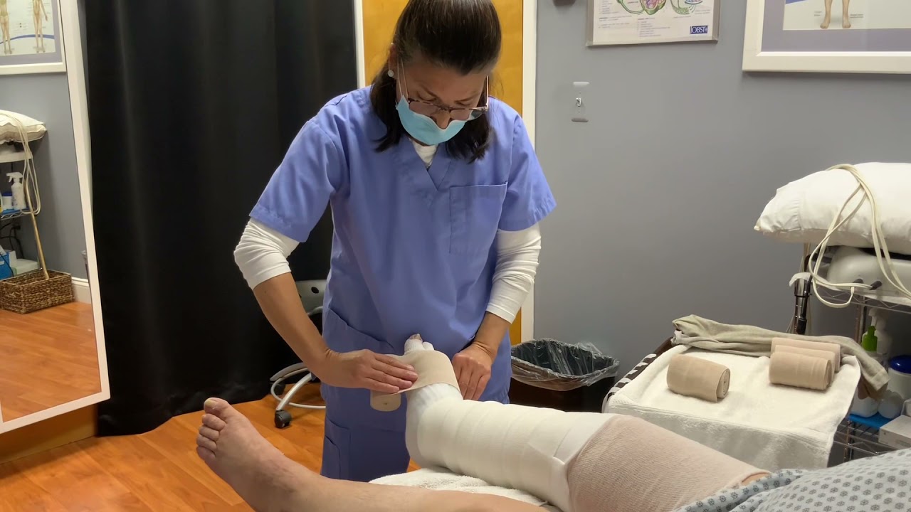 Bandaging a lower extremity with lymphedema YouTube