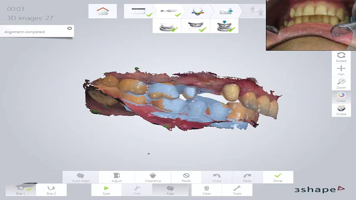 Dr. Hani TOHME: Dmonstration 3Shape