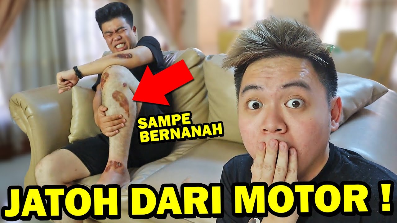 INI PENYEBAB TEMANKU KECELAKAAN PARAH!