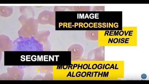 GDIID 2019 | ID 31: INTELLIGENT MALARIA PARASITE CLASSIFICATION & DETECTION IN BLOOD CELL