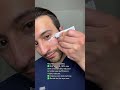 Retinol Eye Cream for Wrinkles & Dark Circles #eyecream #antiagingskincare #skincareproduct #beauty