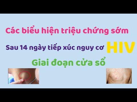 Các biểu hiện triệu chứng sớm 14 ngày tiếp xúc nguy cơ HIV (Giai đoạn ...