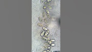 Half Your Cells Are Not Human #cells #bacteria #human #virus