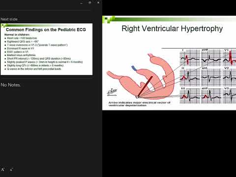 Wideo: Bradykardia U Dzieci: Objawy I Leczenie