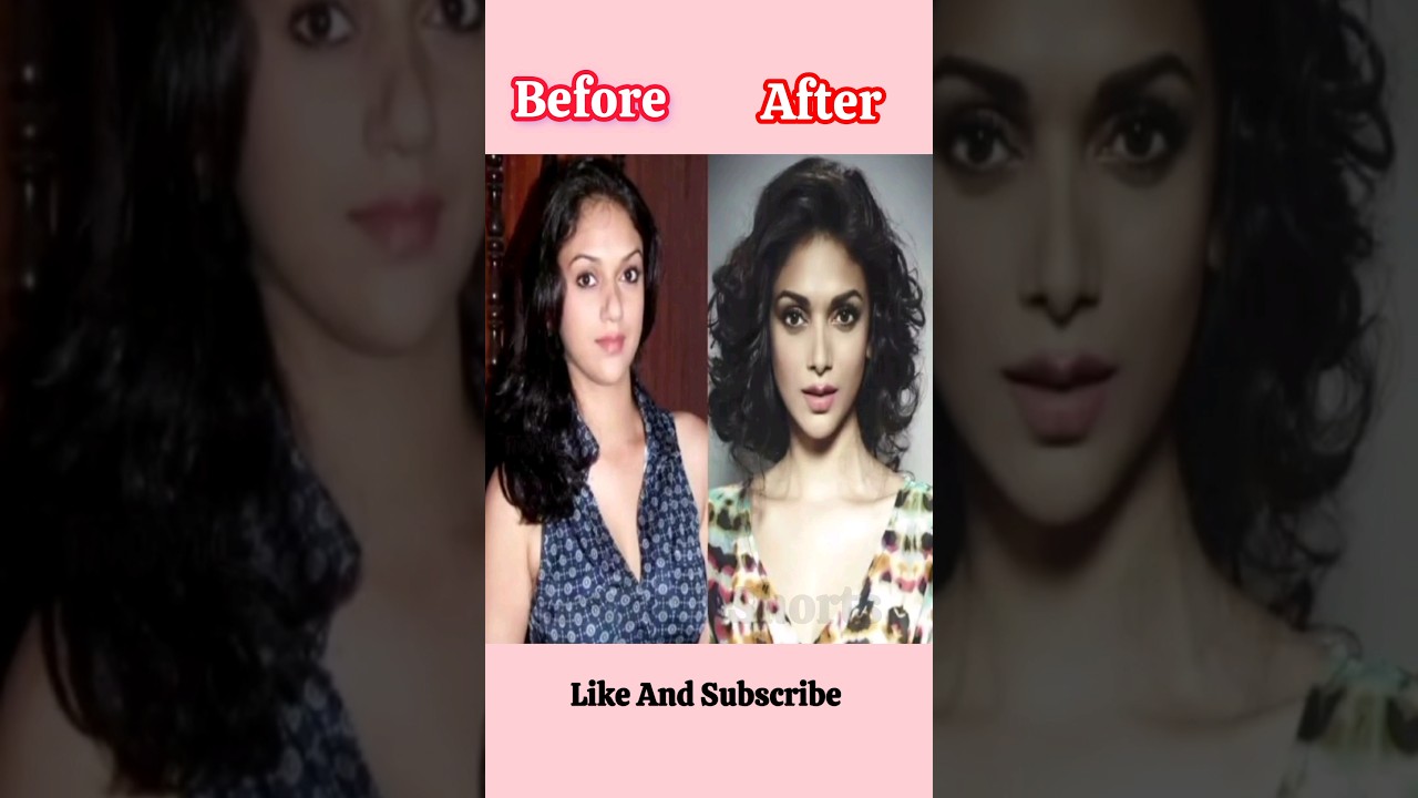 Bollywood Actress Before and After Transformation 😲 by Shubaib Shorts 