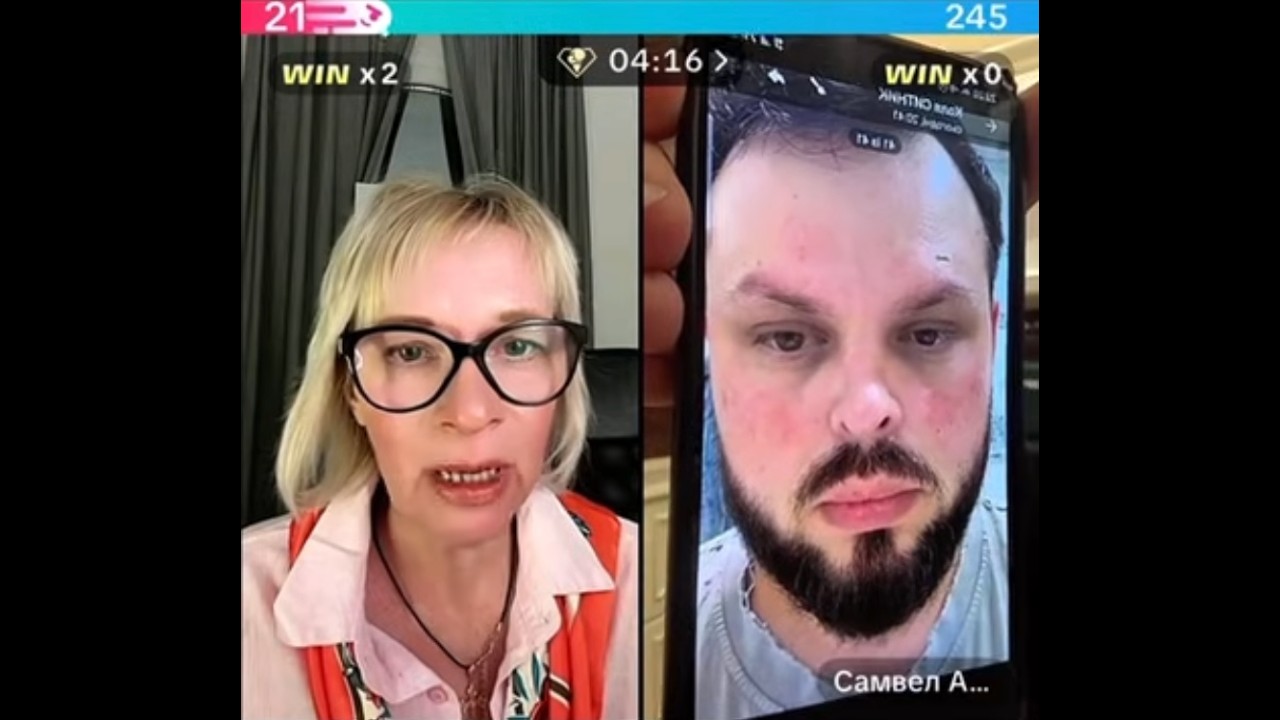 У Натали тоже волчанка, Коле нужно меньше есть и все пройдет, скинул фото / Самвел Адамян Grandeniko