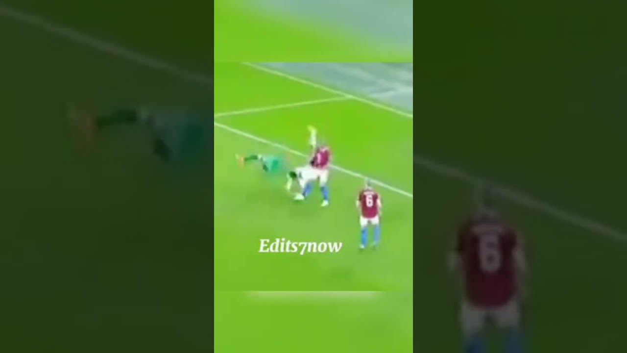 Ronaldo broken nose😭😧