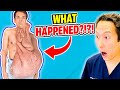 Plastic surgeon reacts to man with 70 lbs tumors of his face extreme bodies explained