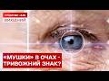 МУШКИ ПЕРЕД ОЧИМА? ЩО ЦЕ МОЖЕ ОЗНАЧАТИ ДЛЯ ВАШОГО ЗДОРОВ’Я