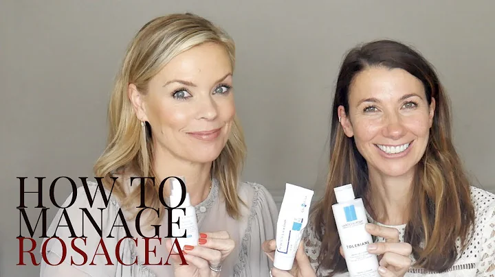 How to manage Rosacea with Rosie Green
