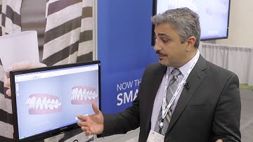 Align Technology on iTero