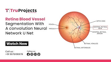Retina blood vessel segmentation with a convolution neural network U net