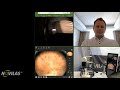 Distant Planning of Retinal Laser Photocoagulation with Navilas®